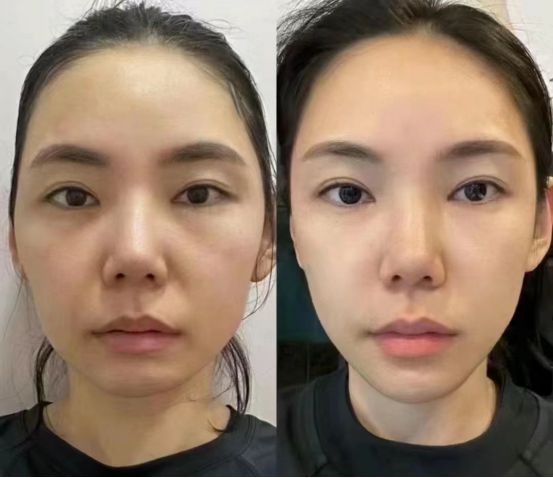 荐2024最值得入手的抗皱国货分享AG旗舰厅首页抗老去皱纹护肤品推(图3)