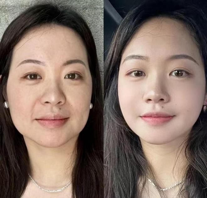 护肤品？揭晓：抗皱第一名国货AG旗舰厅app抗皱纹用什么(图4)